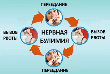 Лечение булимии в Чермене